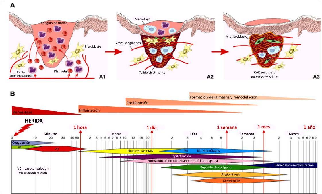 Investigación Herisam
